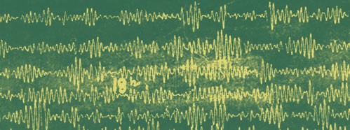 The Problem of Microseisms