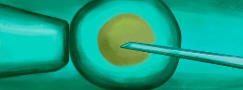 Extra Corporeal Fecundation