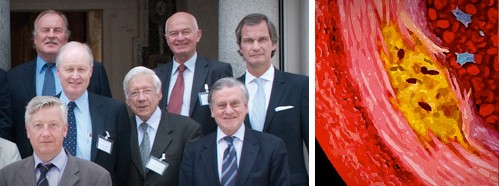 Atherosclerosis: The 21st Century Epidemic